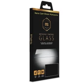 Smcase iPhone 12 Kılıf Negro Karbon Silikon  Nano Ekran Koruyucu - 4