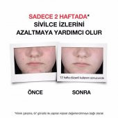 Neutrogena Sivilce Karşıtı Günlük Serum 30 ml - 6