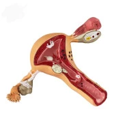 Uterus Pelvik Taban Maketi Model 41 - 1