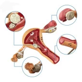 Uterus Pelvik Taban Maketi Model 41 - 3