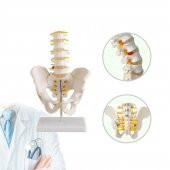 Omurga Pelvis Maketi Model 25 - 3