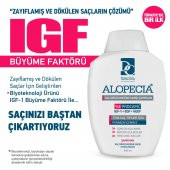 ALOPECİA PROCAPİL VE IGF İÇERİKLİ SAÇ DÖKÜLMESİNE KARŞI ŞAMPUAN 300 ML - 3