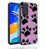 Xiaomi Redmi Note 11 Global Kılıf Desenli Kamera Korumalı Parlak Zore Nora Kılıf - 4