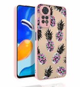 Xiaomi Redmi Note 11 Global Kılıf Desenli Kamera Korumalı Parlak Zore Nora Kılıf - 2