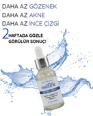 Axodine Retinol Serum Anti-aging Cilt Yenileyici 30 ML - 1
