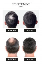 Fontenay Saç Dolgunlaştırıcı Keratin Fibers Koyu Kahve Topik Saç Tozu 50gr X2 - 3