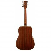 Takamine GD20-NS Akustik Gitar (KILIF+ASKI+PENA) thumbnail 3