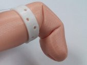 Flexy-Parmak Protezi Plastik Aparat - 4