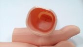 Flexy-Parmak Protezi Plastik Aparat - 5