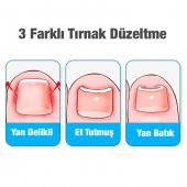 Coofbe Profesyonel 24 Parça Manikür Seti Pedikür Seti Batık Tırnak Önleyici Tırnak Makası Seti Törpü Seti - 6