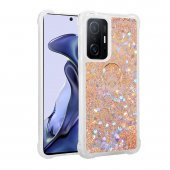 Xiaomi Mi 11T 5G Kılıf Milce Kapak - 1