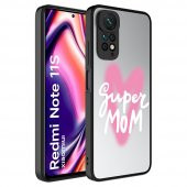Xiaomi Redmi Note 11 Global Kılıf Aynalı Desenli Kamera Korumalı Parlak Mirror Kapak - 1