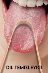 Bakır Dil Temizliyici Dil Sıyırıcı Ağız Temizleyici Dil Bakımı Diş Bakımı - 1