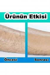 Kristal Epilator Acısız Tüy Dökücü Epilasyon - 2