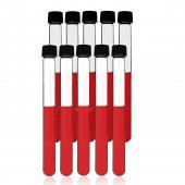 Cam Deney Tüpü 16x160 mm - 20 Adetlik Set - Hacim: 21ml - Isıya Dayanıklı - 3