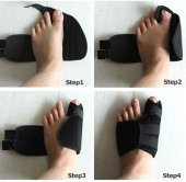 Halluks Valgus Gece Ateli Ayak Baş Parmak Kemik Çıkıntısı Düzeltici Bunyon Tedavisi - 1
