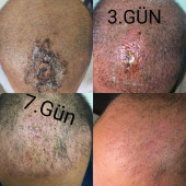 NEKROZ LOSYONU thumbnail 2