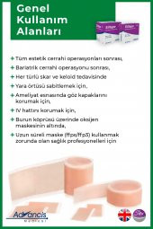 Siltape Soft Silikon Bant Yara Izi - Dikiş Izi - Sezaryen - Yanık - Estetik 2cm X 3mt - 2