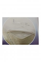 Alez Çift Kişilik Sıvı Geçirmez Yatak Koruyucu160 200 thumbnail 2