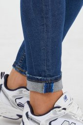 Murratto Erkek Slim Fit Likralı Yırtık Mavi Kot Pantolon - 6