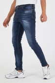 Murratto Erkek Slim Fit Likralı Tırnaklı Koyu Mavi Kot Pantolon - 3