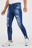 Murratto Erkek Slim Fit Likralı Yırtık Mavi Kot Pantolon - 2