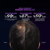 Clear Men Scalp Pro Saç Dökülmesine Karşı Güçlendirici Serum 70 ml - 6
