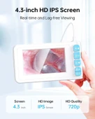 SKYEAR Işıklı Kulak Kiri Temizleme Aracı Kamerası - 4.3 Inc Ekran - 2