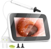 ScopeAround Dijital Otoskop Işıklı, Kulak Temizleme Kamerası - 1