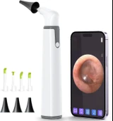 ScopeAround Otoskop, Kulak Kiri Temizleme Aleti ile Birlikte - 3.9 mm - 1