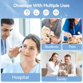 ScopeAround Dijital Otoskop Işıklı, Kulak Temizleme Kamerası - 2