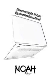 Macbook Pro Kılıf 15.4 inç A1707-A1990 Mac15 Şeffaf 360 Koruma Tropik Çiçekler - 7