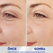 Nivea Q10 Kırışıklık Karşıtı Uzman Bakım Serum 15ml - 7