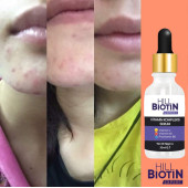 Vitamin C Leke Karşıtı&aydınlatıcı, yüz dolgunlaştırıcı,kompleks serum - 4