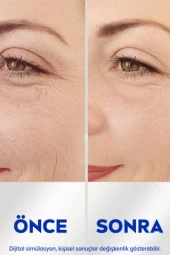 Nivea Q10 Kırışıklık Karşıtı Cilt Serumu 15 Ml, 5 Saf Q10 Ile Yaşlanma Karşıtı Etki thumbnail 4