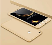 Xiaomi Mi Max 2 Kılıf Ays Kapak - 7
