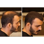 Fixplant 1 Şişe 28 gr Saç Tozu Fiberi - ORTA KAHVE - 2