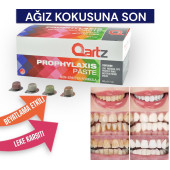 Diş Beyazlatma Pastası 30 ADET - 1