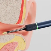 BEBIRD NOTE 5 10MP KAMERA 3.2MM LENS ROBOTİC BAŞLIK ŞARJLI WIFI GÖRÜNTÜLÜ KULAK TEMİZLEYİCİ (6 ADET BAŞLIK DAHİL) thumbnail 2