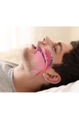 Rahat Uyku İçin Anti Snore Sleep Horlama Engelleyici Aparat Uyku Stoperi - 3