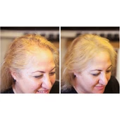 Fixdeep Yeni Nesil Saç Dolgunlaştırıcı Pudra 14 Gr. - Seyrek Saçlar için Saç Fiberi - Fixdeep Suda Çıkmaz - 4