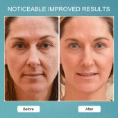 LEFAY Elektrikli Yüz Masaj Cihazı, Kapsamlı Yüz Cilt Bakım Cihazı - 2