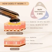 LEFAY Radyo Frekanslı Yüz Makinesi - Evde Yaşlanma Karşıtı Cilt Sıkılaştırma - 4