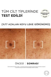 Loreal Paris Bright Reveal Koyu Leke Karşıtı Yüz Serumu 30 ml - 5