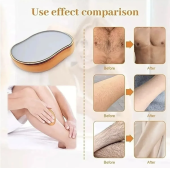 2 ADET Kristal Eraser Epilasyon Tüy Silgi Kristal Epilatör Aleti - 4