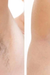 Silver Yüz Bikini Bölgesi Soyulabilir Granül Boncuk Ağda 2 X200gr thumbnail 3