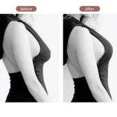 Göğüs Dikleştirme Bandı S Beden 2.5 Cm. thumbnail 2