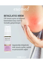 Vücut Beyazlatıcı Diz, Dirsek, Koltuk Altı, Özel Bölge Bikini Bölgesi Kararma Karşıtı Krem 50ml - 4