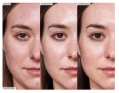 GLOW RECIPE Avocado Ceramide - Cilt Bariyerini Güçlendirme Etkili Serum 30 ML thumbnail 3