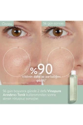Caudalie Vinopure Arındırıcı Tonik 200 ml thumbnail 3